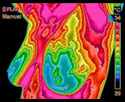 Thermography