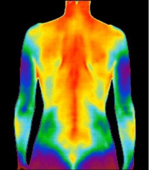 Full Body Thermography